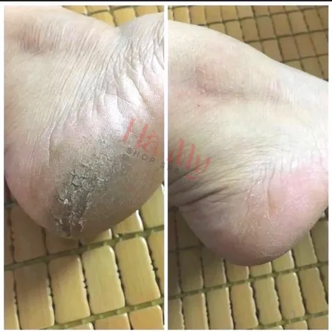 Máy chà gót chân TL-DS01 chính hãng siêu bền khoẻ chuyên dụng tẩy da chết chân tay cho tiệm Nail Spa