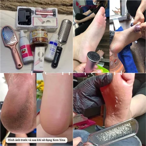 Combo cả set Máy chà gót chân đầy đủ chuyên dụng cho tiệm nail spa hàng chuẩn
