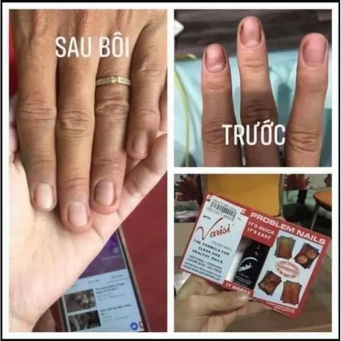 Sét lấy khoé chân chuyên dụng inox không gỉ siêu bén bền đủ bộ cực Hot ngành nail