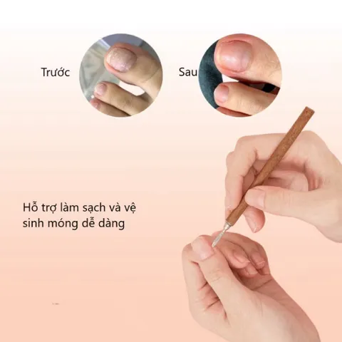 ( Giá sỉ ) Set 10 cây lấy khoé gỗ 2 đầu - Dụng cụ lấy khoé chân Nail thép không gỉ chuẩn Loại 1 lưỡi mảnh siêu bền