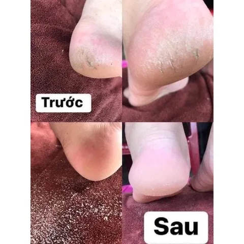 Máy trà gót chân chuyên dụng TL-DS01 chuẩn hãng chạy khoẻ bảo hành