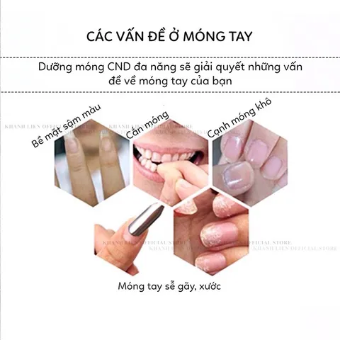 Dưỡng móng CND phục hồi móng siêu tốc , chống gãy dưỡng móng cứng cáp chắc khoẻ hàng chuẩn