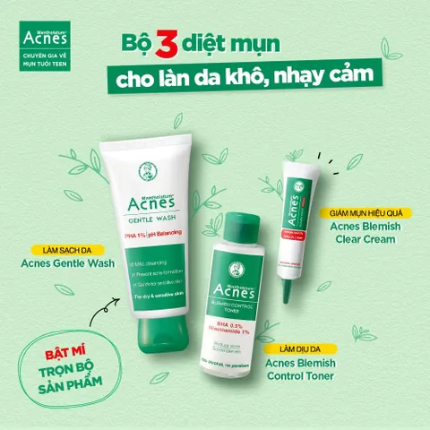 Toner giảm mụn dịu da Acnes Blemish Control Toner White Conc 100ml