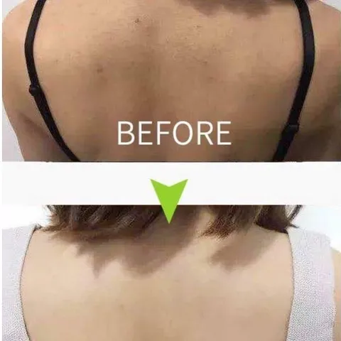 Xà phòng và xịt mụn lưng Pelican For Back Medicated White Conc Nhật Bản