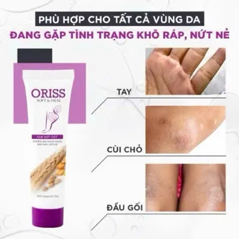 Kem nứt gót và dưỡng da chân tay Oriss tinh chất nghệ và trầu không tái tạo làm hồng gót Tuýp 30gr 847535