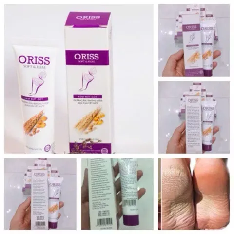 Kem nứt gót và dưỡng da chân tay Oriss tinh chất nghệ và trầu không tái tạo làm hồng gót Tuýp 30gr 847535
