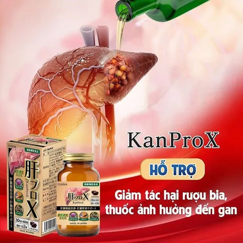 KanProX - Viên uống Hỗ trợ cải thiện chức năng gan, giải độc gan, hộp 60 viên