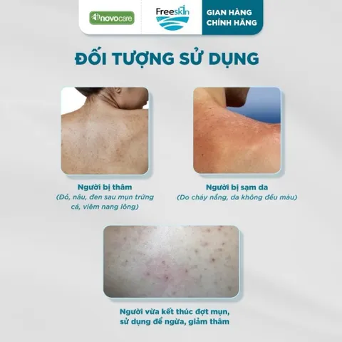 Combo Xịt mụn 80ml & Gel tắm ngừa mụn lưng, viêm nang lông 250g & Xịt mờ thâm 80ml Novocare - Freeskin