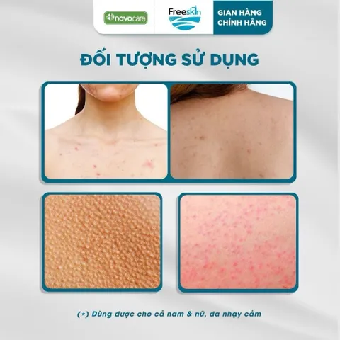 Combo Xịt mụn 80ml & Gel tắm ngừa mụn lưng, viêm nang lông 250g & Xịt mờ thâm 80ml Novocare - Freeskin