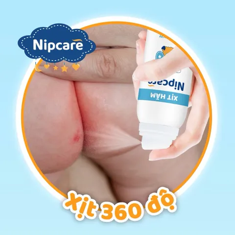 Xịt hăm Nipcare 80ml - Vệ sinh khi thay tã bỉm, ngừa hăm tả dạng phun sương