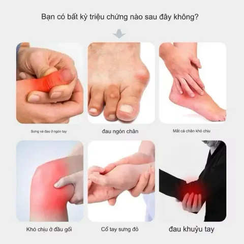 Kem Xoa Bóp Bôi Ngoài Da Baian Shi Tongfengao Giúp Giảm Đau Độ Gút Và Làm Dịu Cảm Giác Sưng Đỏ