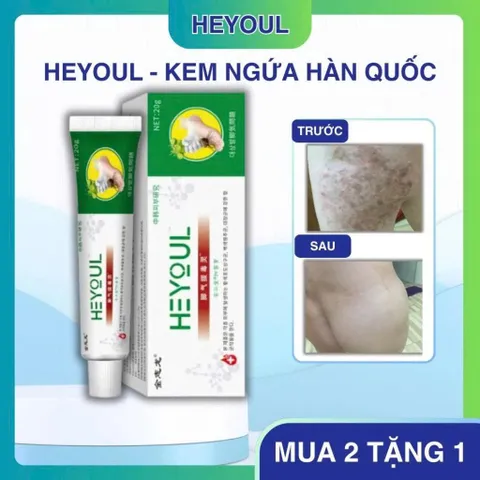 Kem Bôi Da Liễu Heyoul Hàn Quốc, Hỗ Trợ Giảm Ngứa Da Á Sừng Tổ Đỉa, Làm Dịu Da Nhạy Cảm 20g