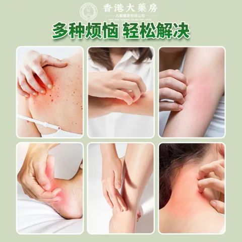 Kem bôi vẩy nến, viêm da kháng khuẩn đánh baynấm da, chống ngứa viêm da, hắc lào,lang ben, mề đay, á sừng