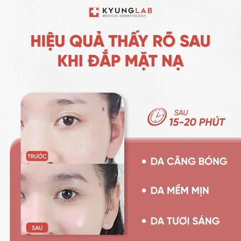 Set 10 Mặt nạ Kyung Lab PDRN Therapy Mask 23ml Hàn Quốc [hàng nhập khẩu full vat]