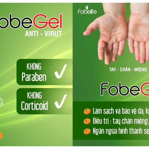 Gel Tái Tạo Anti Virus Fobe Hỗ Trợ Làm Lành Da Do Virus Gây Nên, Thủy Đậu- 15g & 30g
