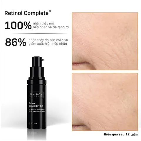 Revision Skincare Retinol 0.5 Serum 30ml - Serum Giảm Nếp Nhăn, Tăng Độ Căng Bóng, Phục Hồi Da, Dưỡng Ẩm Sâu, Chăm Sóc Da Chuyên Nghiệp 866843
