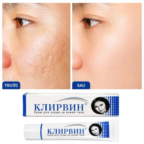 Kem Mờ Sẹo Klirvin Nga 25g, Hỗ Trợ Mờ Thâm, Sẹo Mụn, Rạn Da, Chăm Sóc Phục Hồi Da