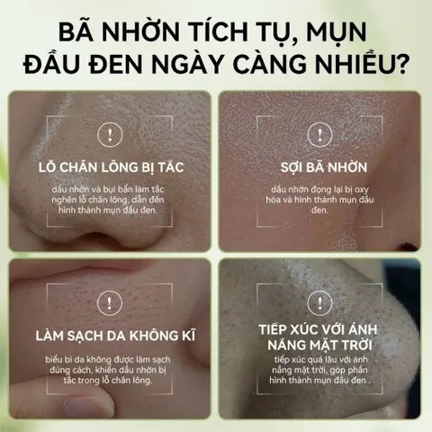 Gel Lột Mụn Nha Đam OKESHOP 30ml - Giải Pháp Loại Bỏ Mụn Đầu Đen, Mụn Cám, Bạ Nhờn & Nhỏ Lcl