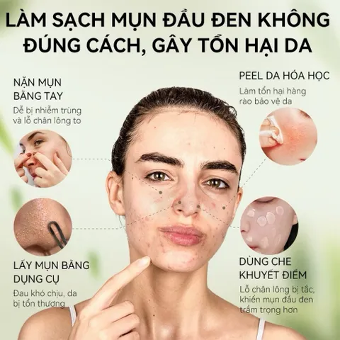 Gel Lột Mụn Nha Đam OKESHOP 30ml - Giải Pháp Loại Bỏ Mụn Đầu Đen, Mụn Cám, Bạ Nhờn & Nhỏ Lcl