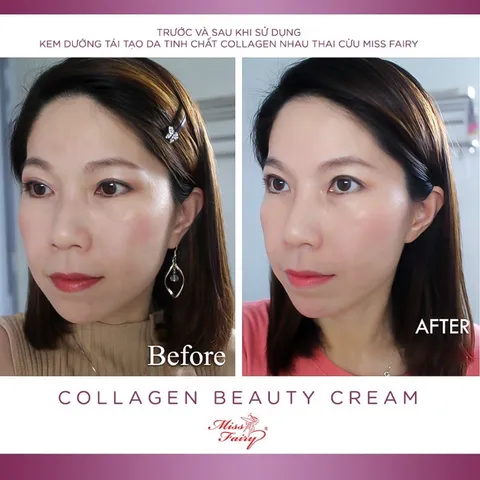 Kem Collagen MISS FAIRY - Nhau Thai Cừu 15g - Làm Trắng - Chống Nhăn - Ngừa Lão Hóa - Tái Tạ Da