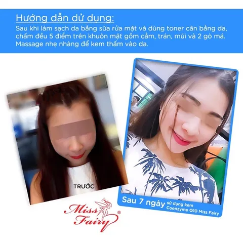 Kem MISS FAIRY Q10 - Dưỡng Trắng Da - Tái Tạo - Mờ Thâm Nám - Tàn Nhang - Đồi Mồi - Giảm Nếp Nhăn