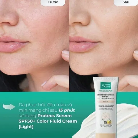 ☀️ Kem Chống Nắng Martiderm Proteos Screen SPF50+ Color Fluid Cream 40ml Chính Hãng