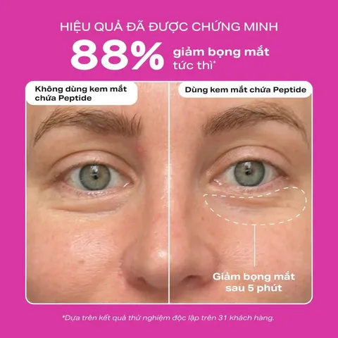 Tinh chất làm săn chắc da và giảm nếp nhăn cho vùng mắt Paula’s Choice 15ml-Chính hãng nhập khẩu