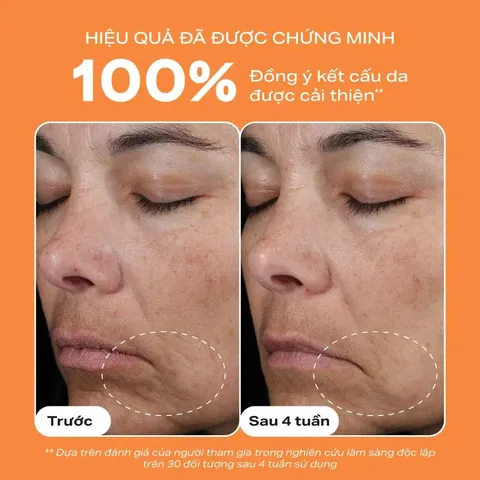 Tinh chất làm sáng da, mờ thâm nám và giảm nếp nhăn chứa 15% Vitamin Paula's choice C15 Super Booster-chính hãng nhập khẩu
