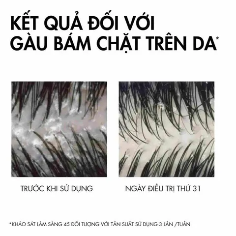 Vichy Dầu Gội giảm gàu ngứa Dercos Anti- Pelliculaire Sensitive 200ml 