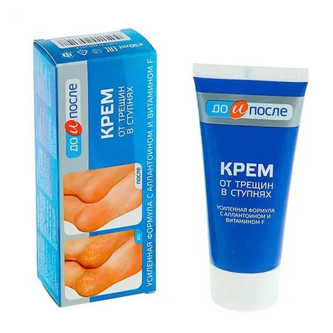 Kem Hỗ Trợ Giảm Nứt Gót Chân Dưỡng Mềm Mịn Kpem Apteka 50ml