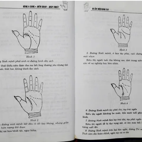 Bí Ẩn Trên Bàn Tay