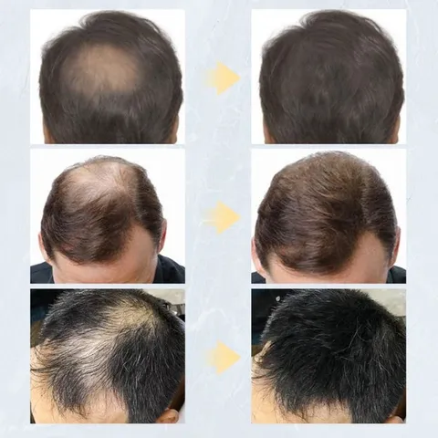 Toppik LƯỢC ĐỊNH HÌNH CHÂN TÓC phụ kiện tạo sợi tóc toppik