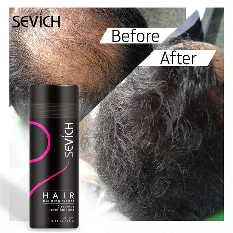 SEVICH Bộ 3 sản phẩm Chăm sóc Làm dày Tóc, Che Hói và tóc thưa