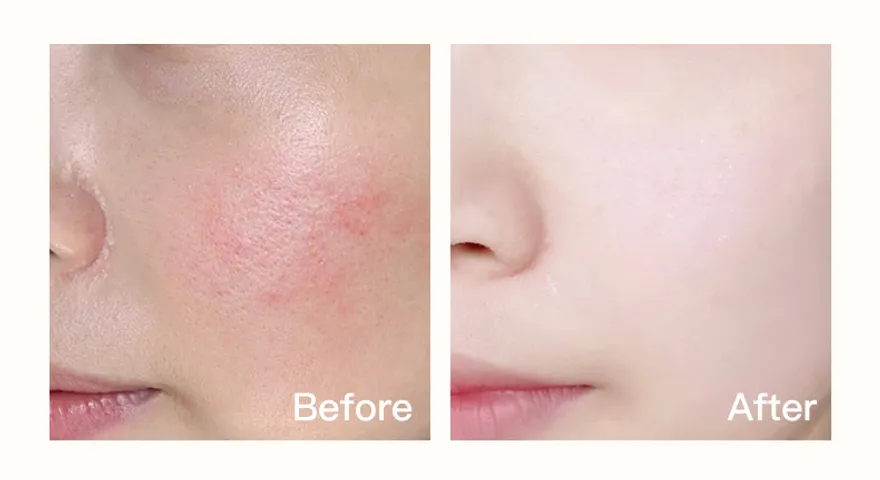 Máy Đẩy Tinh Chất & Nâng Cơ Massage Mặt HIH