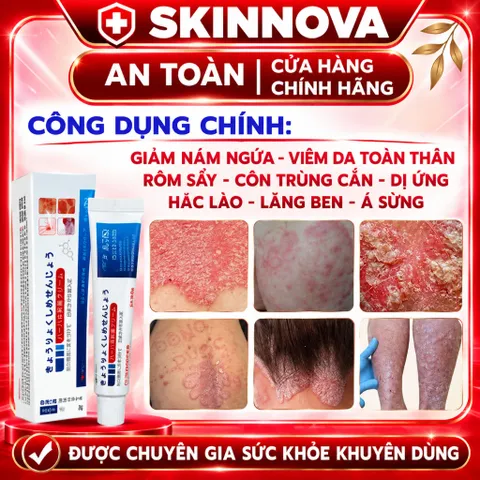 3 TUÝP TẶNG 1 Kem Bôi Nấm Ngứa Viêm Da Cơ Địa NHẬT BẢN Hắc Lào, Tổ Đỉa, Vẩy Nến, Á Sừng, Lang Ben Hiệu Quả