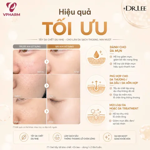 Gel Tẩy Da Chết Sinh Học +Dr.lee Clean Solution Peeling Magic 100g