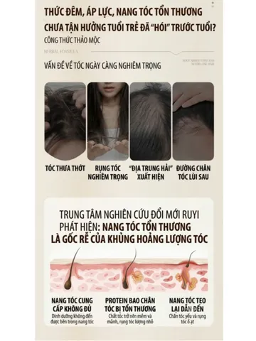 [100ML/Chai] Tinh nhất ngăn rụng tóc RUYI, hỗ trợ mọc tóc và giúp chân tóc chắc khỏe hơn