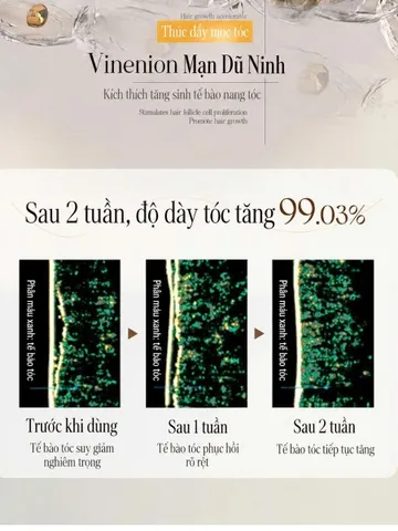 [100ML/Chai] Tinh nhất ngăn rụng tóc RUYI, hỗ trợ mọc tóc và giúp chân tóc chắc khỏe hơn