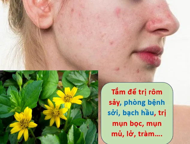 Cây sài đất  hay xoài đất, cúc nháp, húng trám, ngổ núi, hoa múc, sơn cúc bò - 1kg tươi, 500g khô