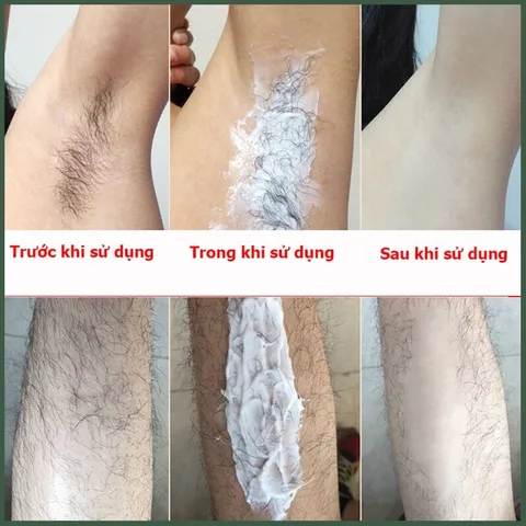 Kem Tẩy Lông Vĩnh Viễn Cho Nam Giới,Kem tẩy lông râu,tay,chân,triệt lông an toàn vĩnh viễn không gây kích ứng 60g