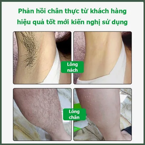 Kem Tẩy Lông Vĩnh Viễn Cho Nam Giới,Kem tẩy lông râu,tay,chân,triệt lông an toàn vĩnh viễn không gây kích ứng 60g