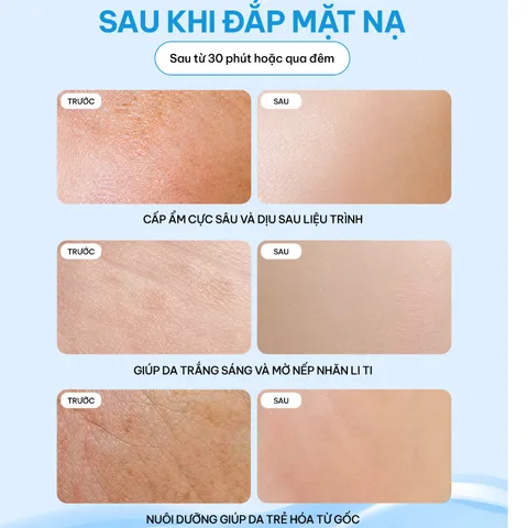 [KOREAN] MẶT NẠ RAU MÁ EXOCICA 28G/MIẾNG – EXOCICA MASK, LÀM DỊU, CẤP ẨM, GIÚP DA MỀM MỊN, PHÙ HỢP DA YẾU VÀ DA NHẠY CẢM