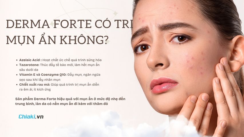 Derma Forte có trị mụn ẩn không? Cách dùng đúng tránh đẩy mụn