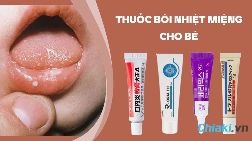 TOP 5 thuốc bôi nhiệt miệng cho bé nhanh khỏi, an toàn