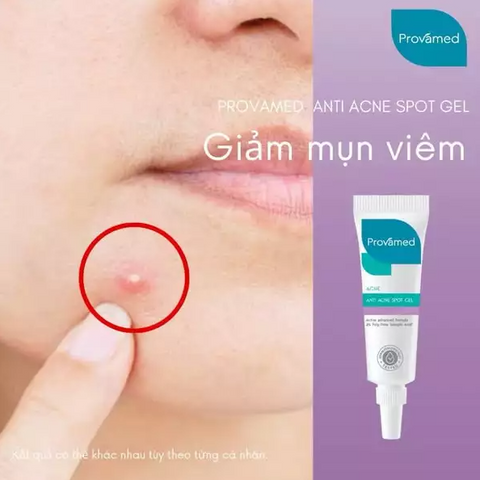 Gel Hỗ Trợ Giảm Mụn Trứng Cá Provamed Acne Spot Gel 10g - Giảm Viêm, Làm Dịu Da, Ngăn Ngừa Mụn Mới