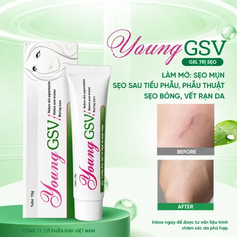 (Hàng chính hãng) Gel Young GSV Tuýp 15g - Hỗ Trợ Làm Mờ Sẹo, Giảm Thâm Mụn
