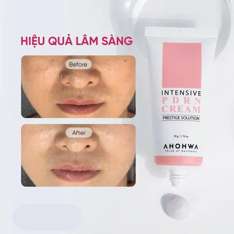 (Hàng nhập khẩu) Kem Ahohwa Intensive PDRN Cream 50g - Hỗ Trợ Phục Hồi, Dưỡng Ẩm Da