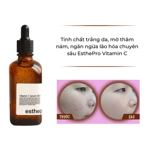 (Hàng nhập khẩu) Esthepro Vitamin C Serum 561 100ml - Tinh Chất Hỗ Trợ Dưỡng Sáng Da