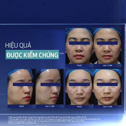 (Hàng nhập khẩu) Kem dưỡng trẻ hóa da ban đêm Obagi Medical Retinol + PHA 50ml