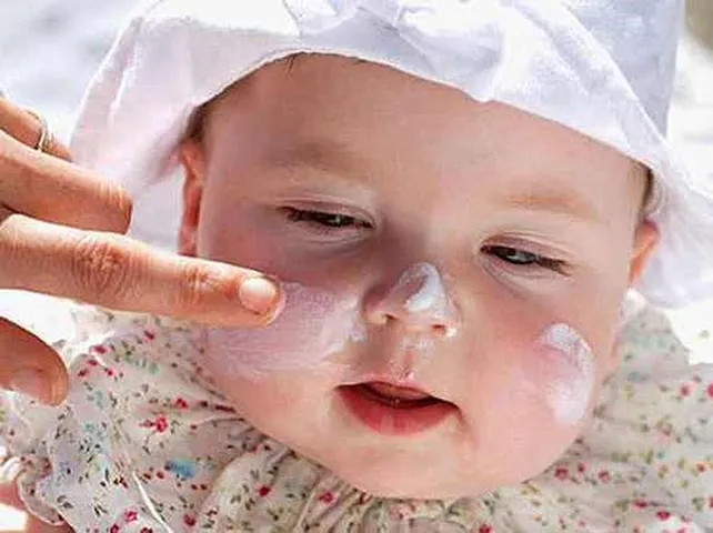 Cách trị rôm sảy cho bé “HIỆU QUẢ” “AN TOÀN” mẹ nên biết